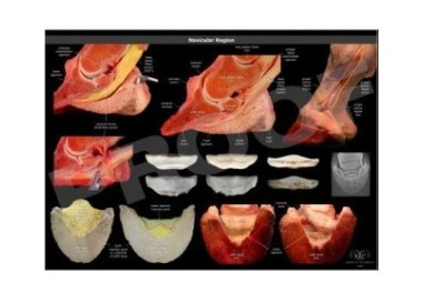 POSTER REGION NAVICULAR