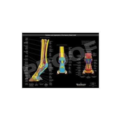 POSTER LIGAMENTOS Y TENDONES