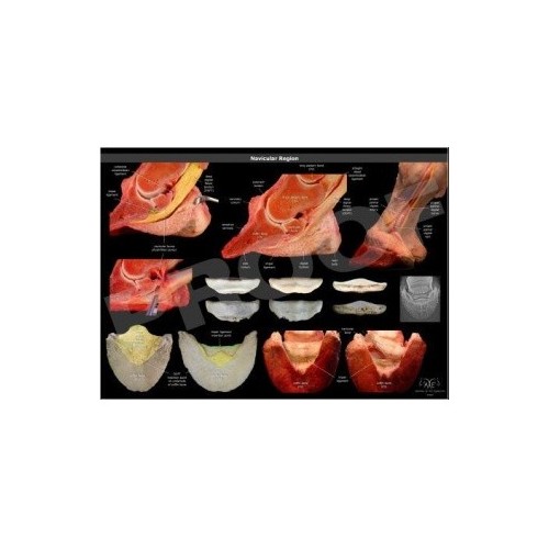 POSTER REGION NAVICULAR