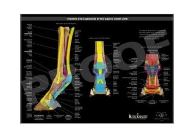 POSTER LIGAMENTOS Y TENDONES